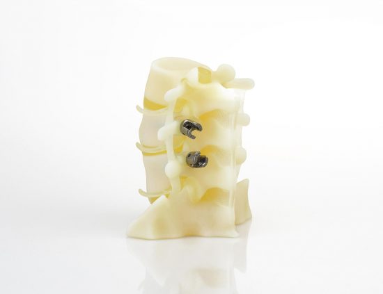 polyjet spine